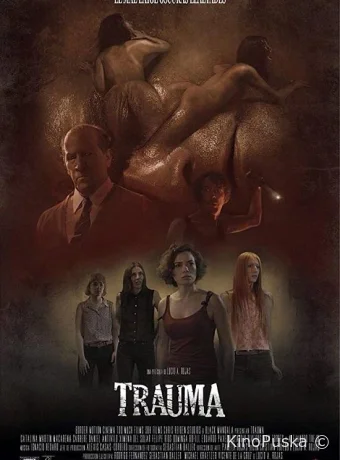 Травма 